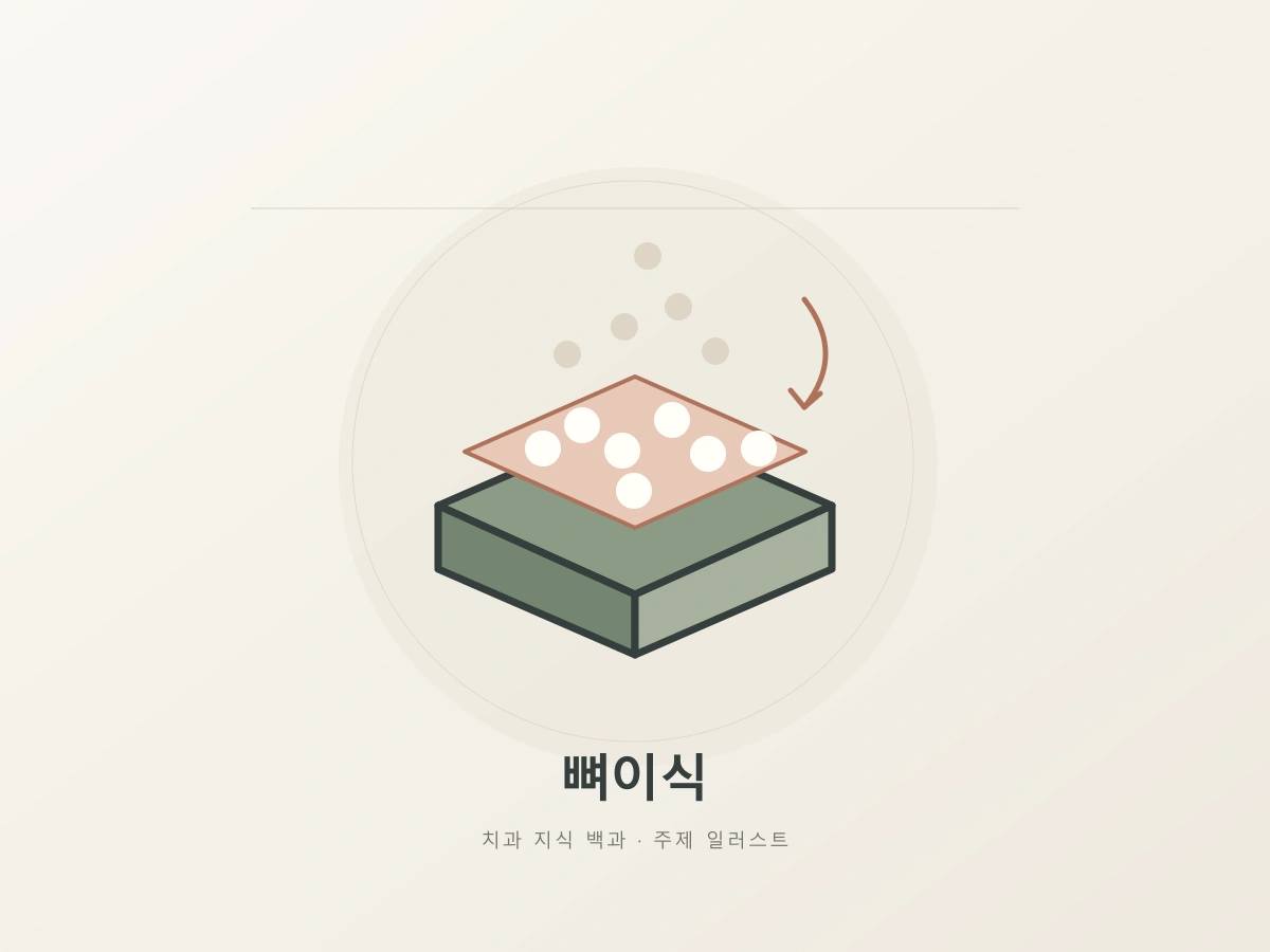 뼈이식 상담 주제를 나타내는 지지층과 쌓이는 입자의 추상 일러스트