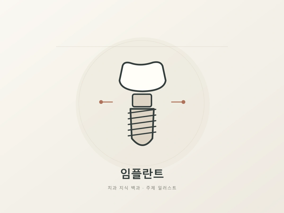 임플란트 주제를 나타내는 결합 부품과 나사 형태의 상징 일러스트