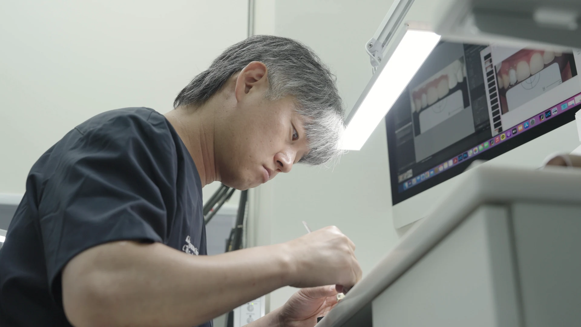 院内技工室、補綴物をつくる人とその工程